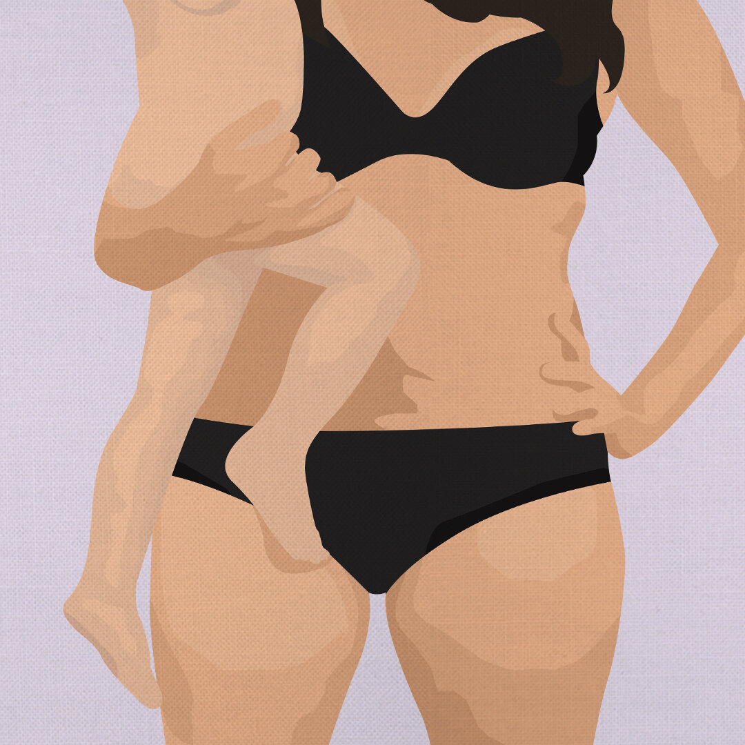 PAPRAS - POST PREGNANCY BODY.jpg